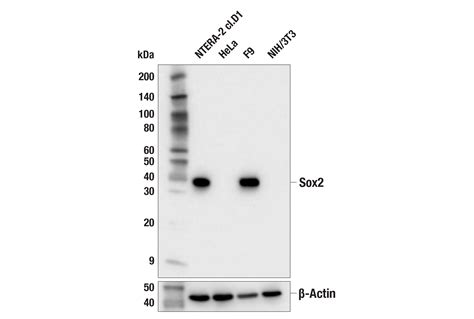 Sox E I X Rabbit Mab Cell Signaling Technology