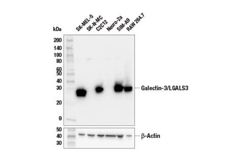 Galectin 3 LGALS3 E7B6R Rabbit MAb Cell Signaling Technology