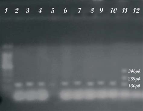 Amplificación Por Pcr Para El Gen Rfbo157 Stx 2 Y Stx 1 Pozos 1