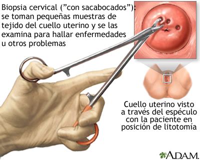 Teseo cinta detergente señales de cancer de utero Puñalada Penetración