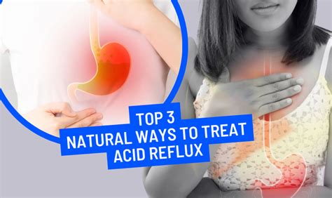 Top 3 Amazing Natural Ways To Treat Acid Reflux Kairali Ayurvedic Center