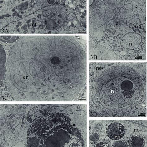 Transmission Electronic Micrographs Of Ovarioles Of Apis Mellifera