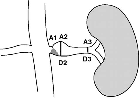 Mdct Angiography Of The Renal Arteries In Patients With Atherosclerotic