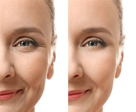 Beautiful Mature Woman Face Before After Royalty Free Images