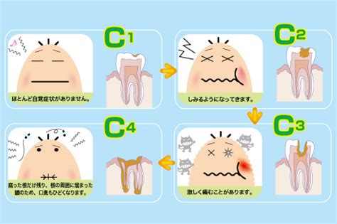 虫歯の進行を止めるためにはどうする？ 難波の歯医者 なんばアップル歯科