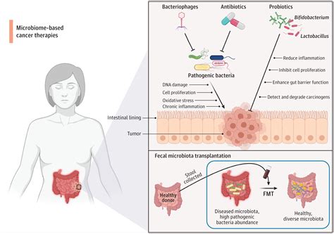 The Potential Of The Gut Microbiome To Reshape The Cancer Therapy