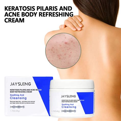 Jaysuing Keratosis Pilaris And Acne Body Refreshing Cream Back Acne