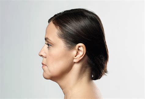 Double Chin | Dr. Ricardo Ruz