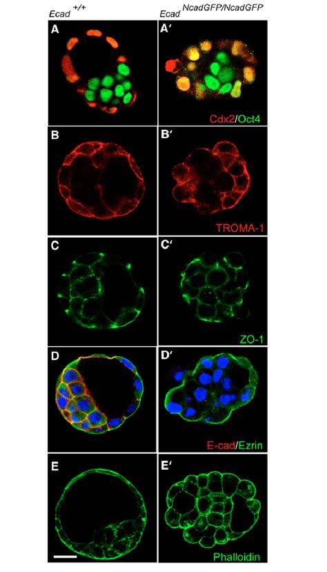 Expression Of Trophectodermal And Lineage Specification Markers In Ncad