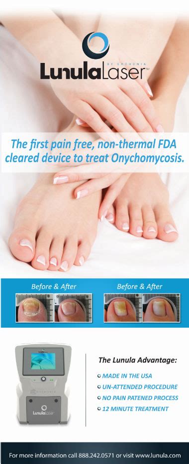 Laser Nail Fungus Valencia Foot Ankle Center Valencia Ca