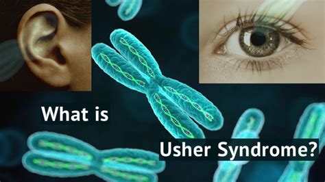 Usher Syndrome Types