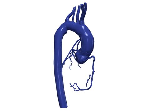 D Model Of Aorta And Coronary Arteries Aorta Embodi D