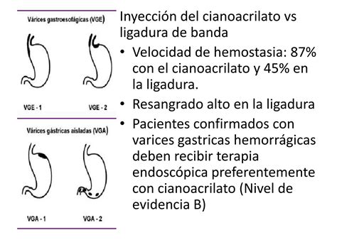 Manejo Del Sangrado De Tubo Digestivo Alto Variceal PPT