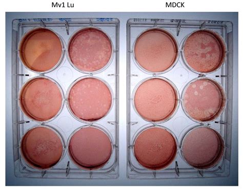 Higher Titers Of Some H5N1 And Recent Human H1N1 And H3N2 Influenza