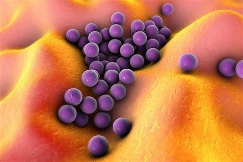 Mrsa Overview Bruker