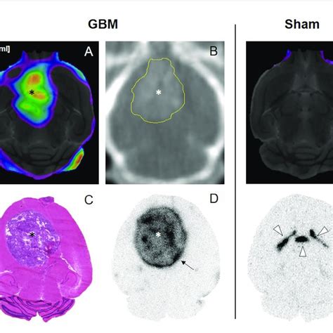 18 F PSMA 1007 PET A E CT B H E C And Ex Vivo ARG D F