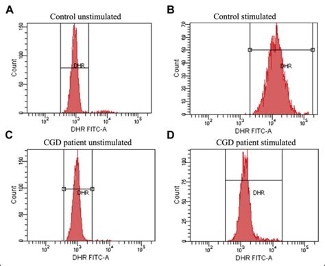 A Granulomatous Chronic Disease The American Journal Of Medicine