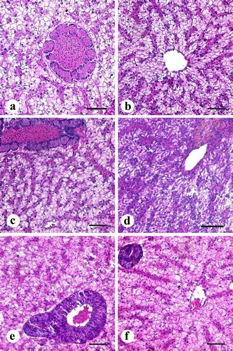 Histomorphology Of Nile Tilapia Hepatopancreas A Control Group Download Scientific Diagram