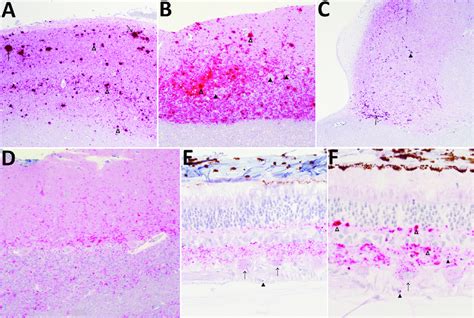 Immunohistochemical Analysis For The Prion Protein Showing Scrapie