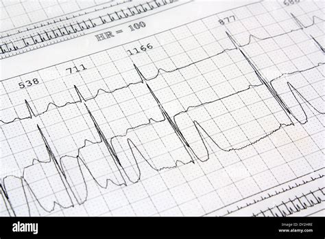 Electrocardiograma Ekg Ritmo Cardíaco Antecedentes Fotografía De Stock Alamy