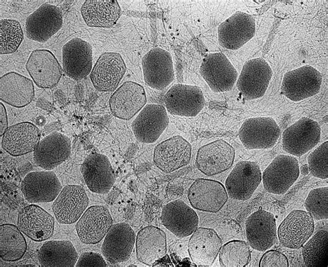 What is Electron Microscopy and Its Applications?