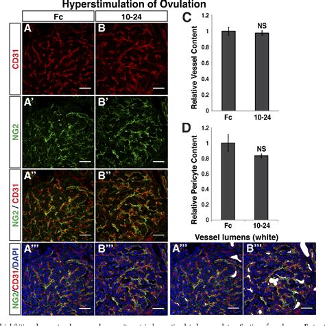 Figure 1 From Inhibition Of Jagged Specific Notch Activation Reduces