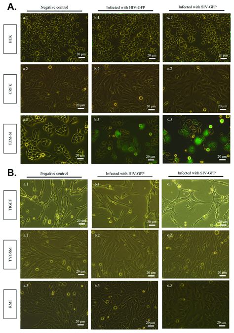 Detection Of SIV GFP And HIV GFP Infection By Fluorescence Microscopy