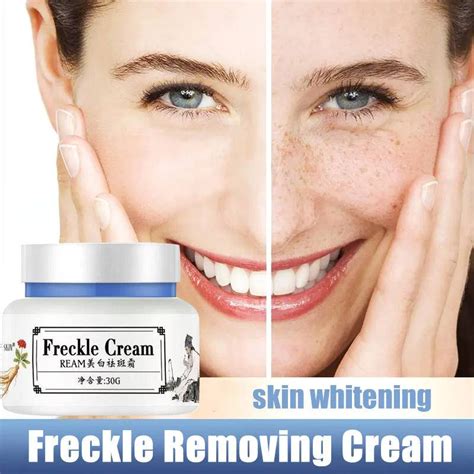 Freckle Removal Cream Whitening Anti Aging Melasma Removal Dark Spots