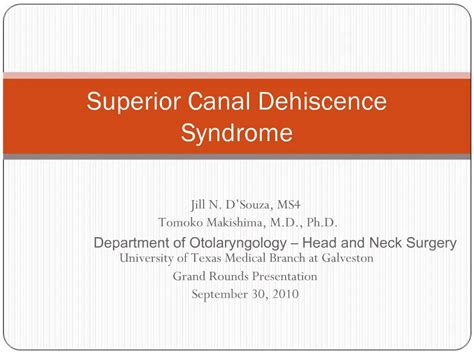 Ppt Superior Canal Dehiscence Syndrome Powerpoint Presentation Free