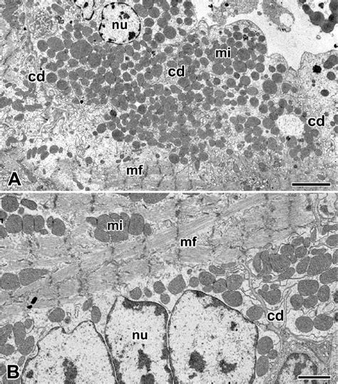 Electron Micrographs Of The Cardiac Muscle Cells In The Orb Web Spider