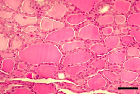 Systemic Pathology Exam Endocrine Exocrine Flashcards Quizlet