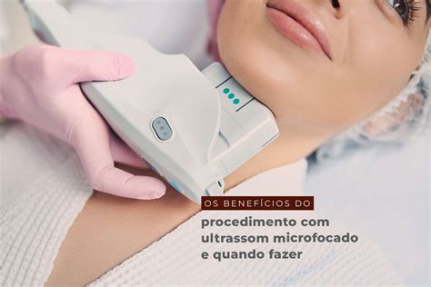 Os Benefícios Do Procedimento Com Ultrassom Microfocado