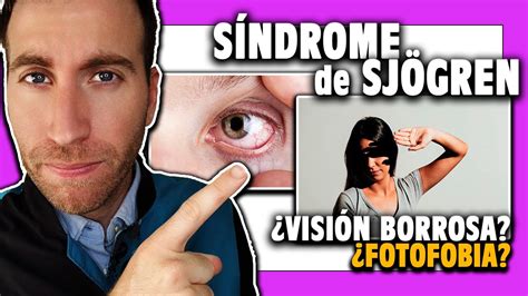 🟣 ¿qué Es El SÍndrome De SjÖgren Síntomas Y Consecuencias Youtube