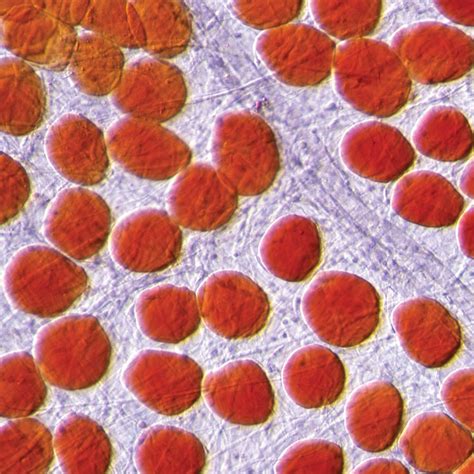 Mammal Adipose Tissue, w.m., Sudan-IV stain Microscope Slide | Carolina ...