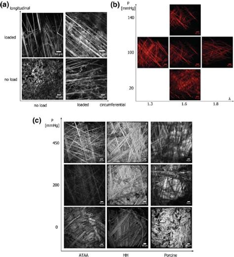 Multiphoton Images Obtained During A Uniaxial Tension In The