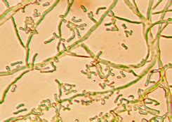 Figure 11 Actinomycetes: MIG - TML & MSH MicroWeb