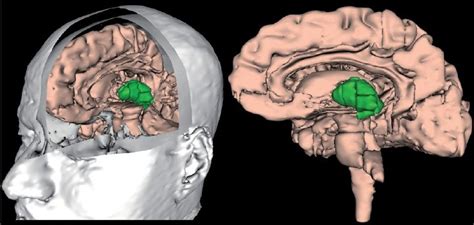 Thalamus | Anatomy, Location, Structure, Function & Physiology