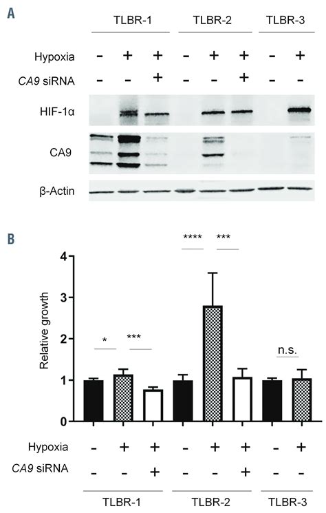 Molecular Profiling Reveals A Hypoxia Signature In Breast Implant