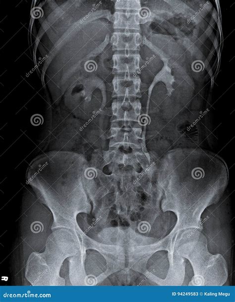 Abdominal X Ray Anatomy - Anatomical Charts & Posters