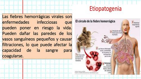 SOLUTION FIEBRE HEMORRAGICA VIRAL Studypool