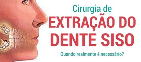 Cirurgia para Extração do Dente Siso Você precisa