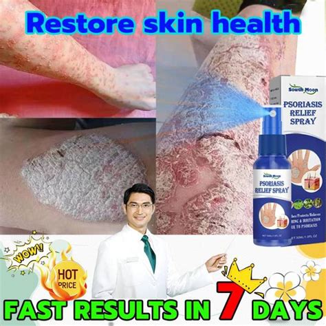 Antibacterial Psoriasis Cream Herbal Treatment Eczema Relief Itch Rash