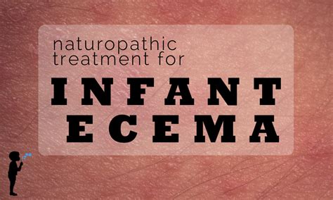 Infant Eczema - naturopathic tips and treatment