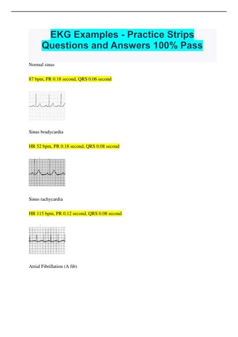 Ekg Examples Practice Strips Questions And Answers 100 Pass Stuvia Us