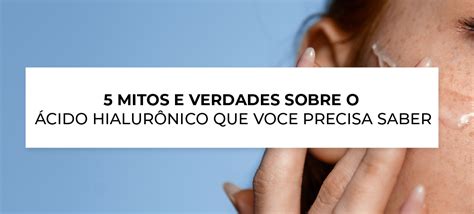 5 Mitos E Verdades Sobre O Ácido HialurÔnico Que VocÊ Precisa Saber