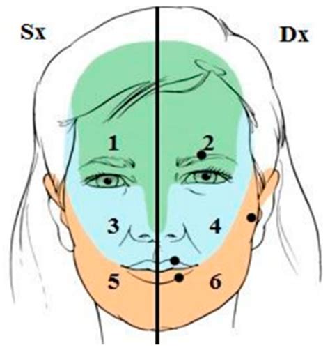 Sternocleidomastoid Trigger Points