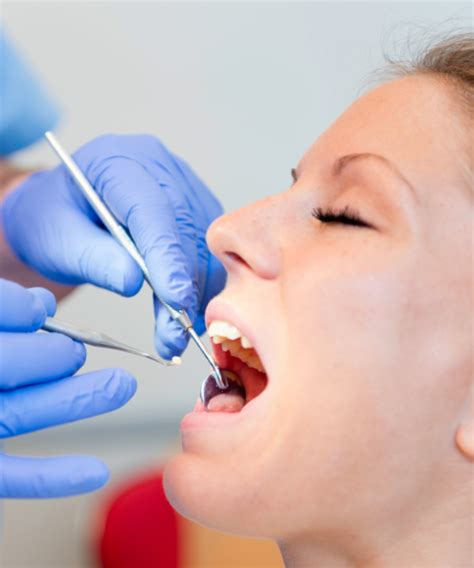 Dental Health And Tooth Filling All You Need To Know Oyster Dental