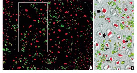 A B Immunofluorescence Localization Of Hla Dr Molecules In Patient