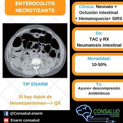 CONSALUD ENARM En Instagram ESTUDIA INTELIGENTE ESTUDIA CONSALUD