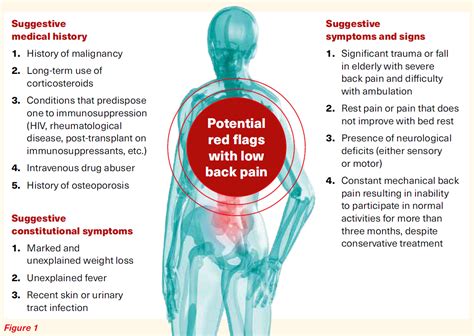 Low Back Pain Red Flags Singhealth Duke Nus Spine Centre